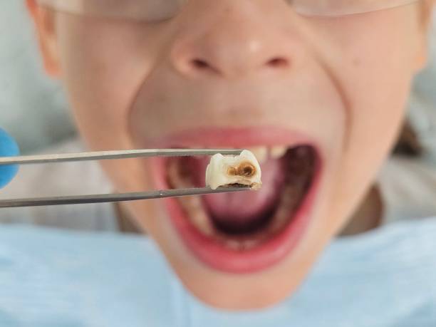 Best Walk-In Emergency Dentist in Mayo, SC