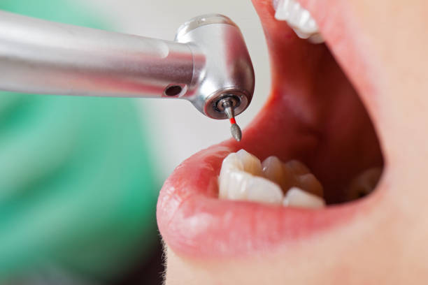 Best Weekend Emergency Dentist in Mayo, SC